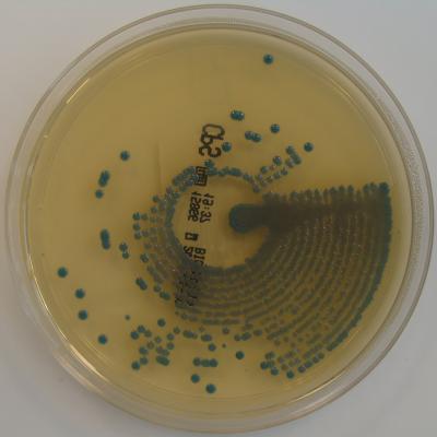 bakterija klebsiella