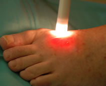 ganglion