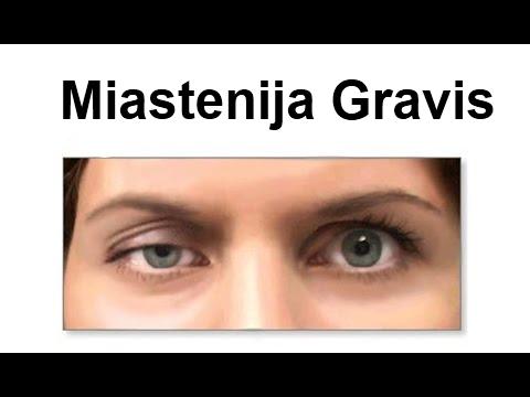 miastenija