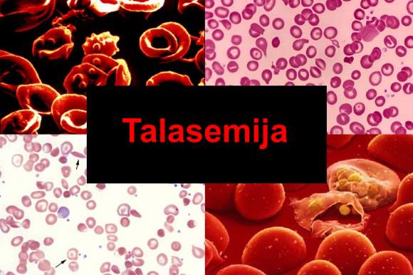 talasemija