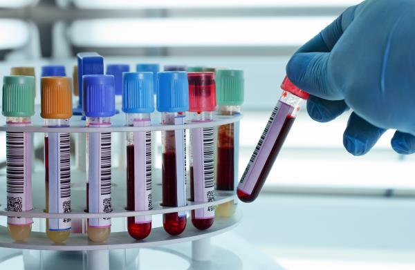 hemoglobin i hematokrit